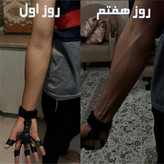 کش تقویت مچ و ساعد مدل گریپستر