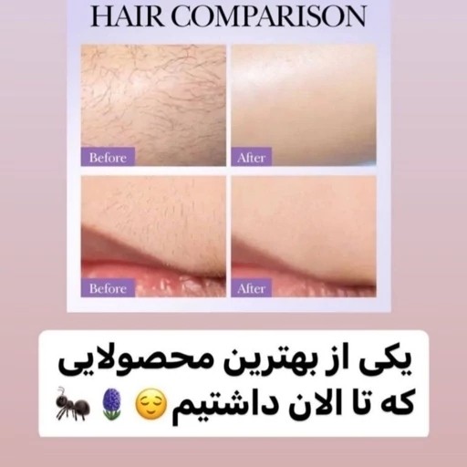 روغن مورچه اصل اورجینال اسپری ضد رشد موی زائد پوستی
