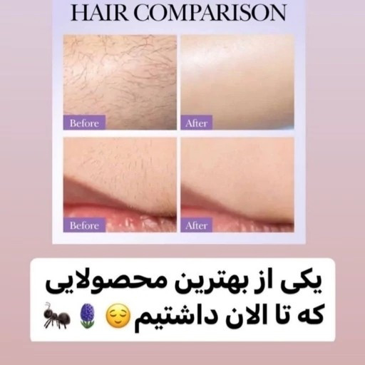 روغن مورچه اصل اورجینال اسپری ضد رشد موی زائد پوستی