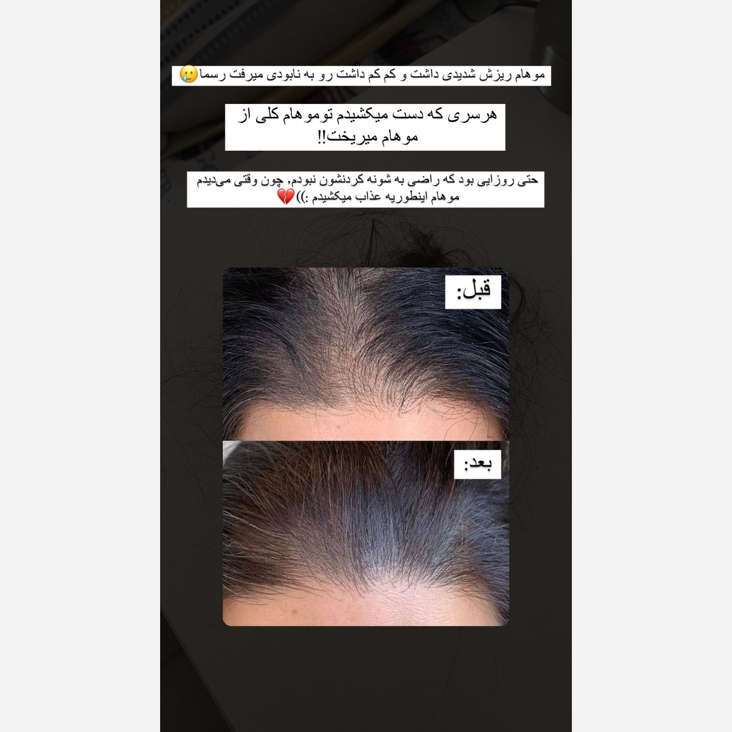 محلول رویش مجدد تقویت مو رشد موها پرتیین تقویتی ضد موخوره مخصوص همه موها و مو اسیب دیده محلول تقویت ریش