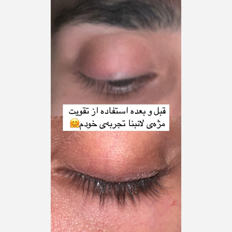 لوسیون تقویت مژه اصل اورجینال سرم تقویتی مژه ها و ابرو پرپشت کننده ضد ریزش بلند کننده ضخیم کننده مژه ها و ابرو ها چشم